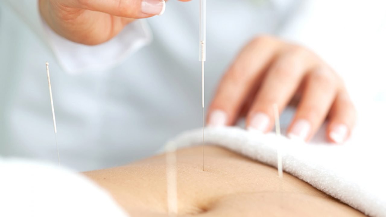 All you need to know about tcm acupuncture fertility Singapore 